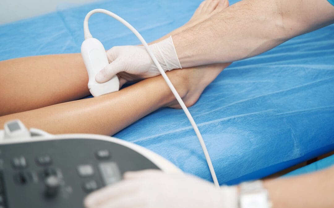 The Most Commonly Asked (and Rarely Answered) Questions About Vascular Surgery